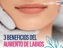 3 beneficios del aumento de labios