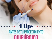 4 Tips, antes tu procedimiento Quirúrgico
